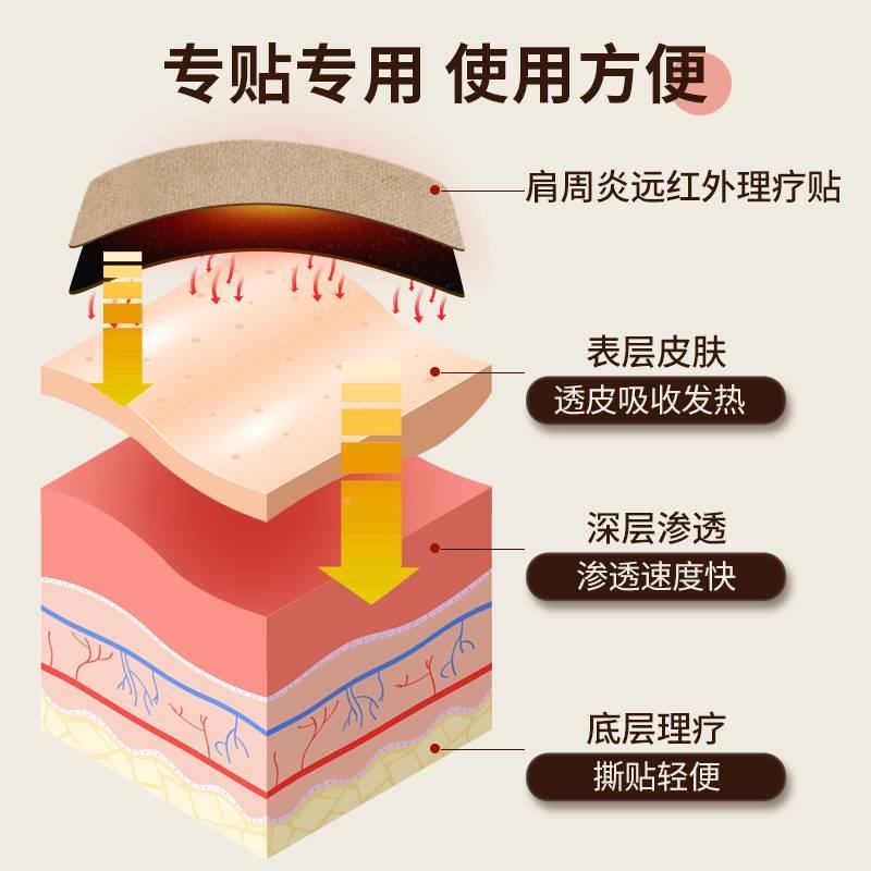 炎修正肩周专贴膏远膀红外理疗HX-II贴肩疼用痛非膏药贴热敷贴包 - 图1