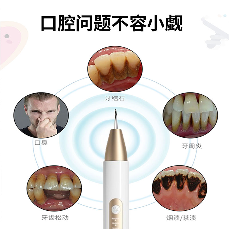 超声波洁牙仪家用洗牙器冲牙结石去除神器牙齿清洁污垢除牙垢牙石 - 图2