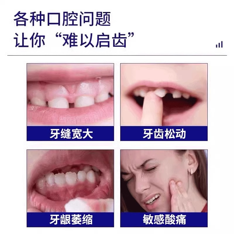 牙缝宽大牙齿敏感导致牙龈萎缩可搭牙膏牙疼牙龈萎缩修松动FJ - 图0