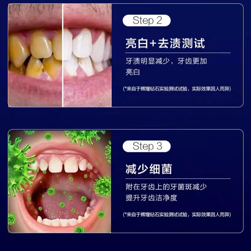 【白牙神器】去黄牙黑牙垢烟渍茶渍洁白牙齿脱色剂牙斑净正品正牌 - 图2