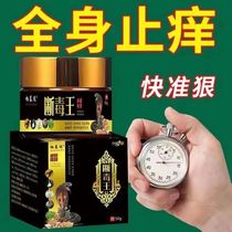 (Official) (Fast removal of psoriasis) Psoriasis Specialty Medication Head Rinderi Dermatophyte Dermatophytes