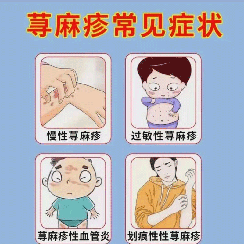 丘疹性荨麻疹膏过敏止痒皮肤瘙痒急性特提高效免疫力医用&正品VG,淘宝优惠券,粉丝福利购,淘宝优惠卷