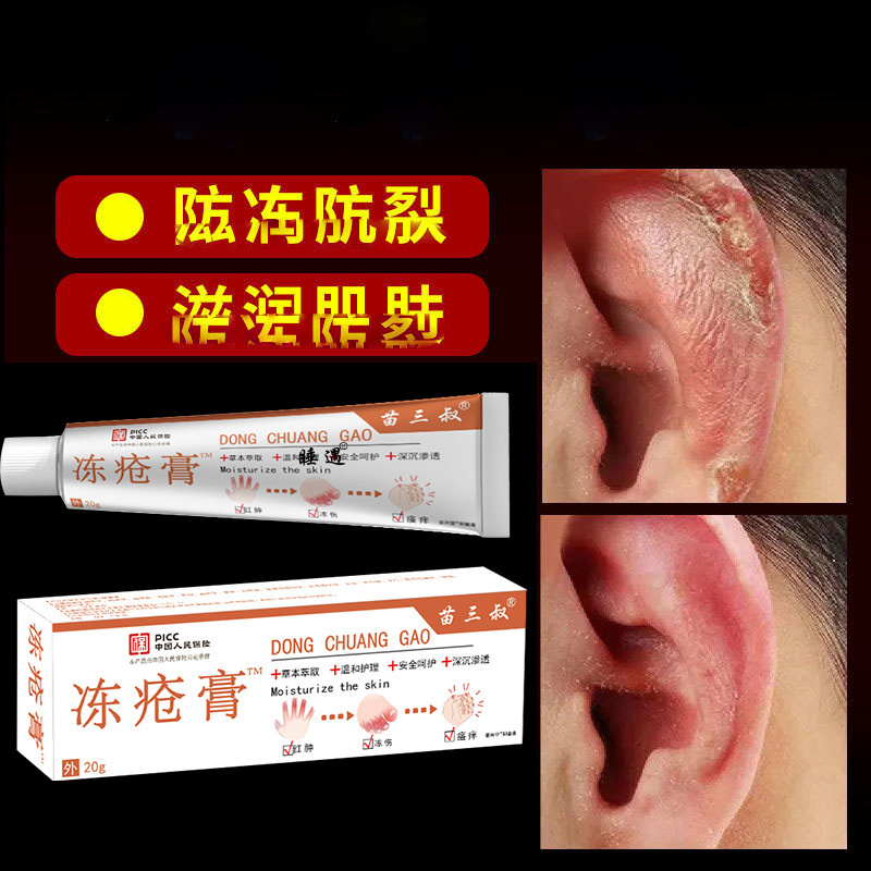 苗三叔蛇油冻疮膏本草手脚冻裂膏脚后跟皱裂皮肤干燥蜕皮护理膏