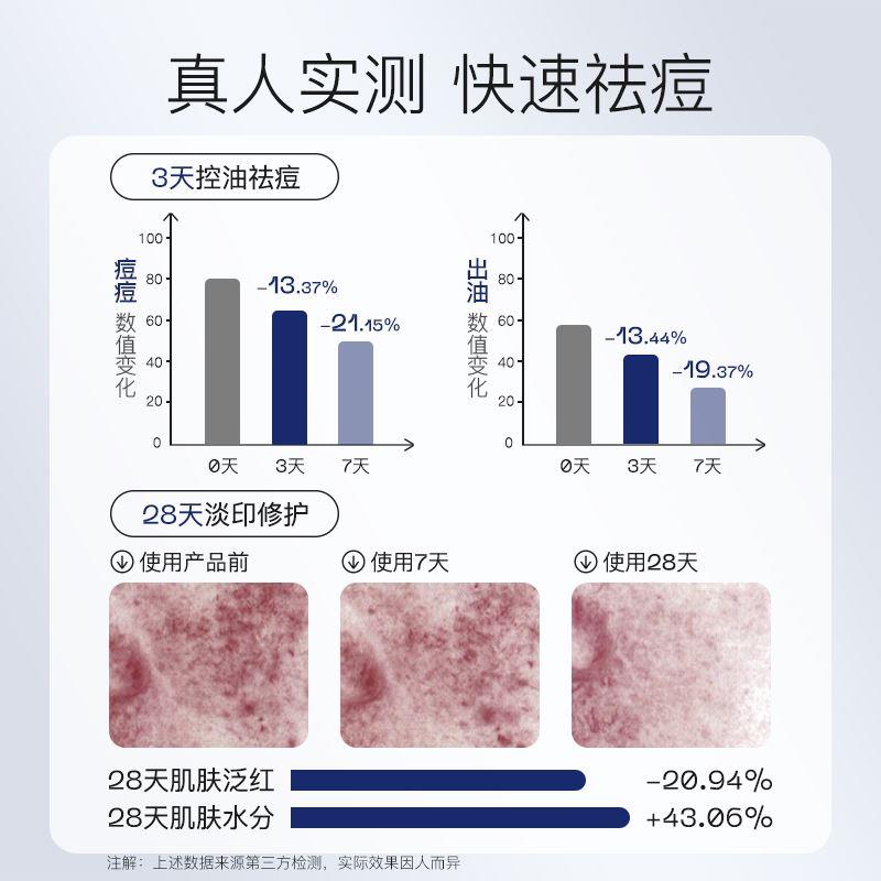 奢思雅祛痘精华液祛痘淡印抑痘控油改善闭口粉刺222祛痘精华30ml-图2