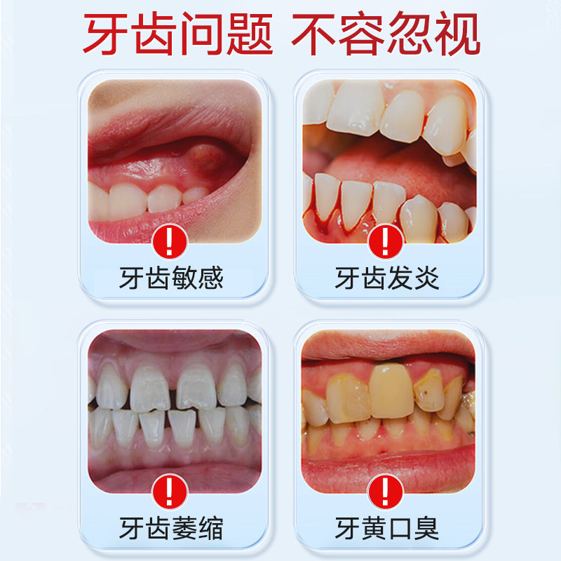  坂崎制药牙齿脱敏剂