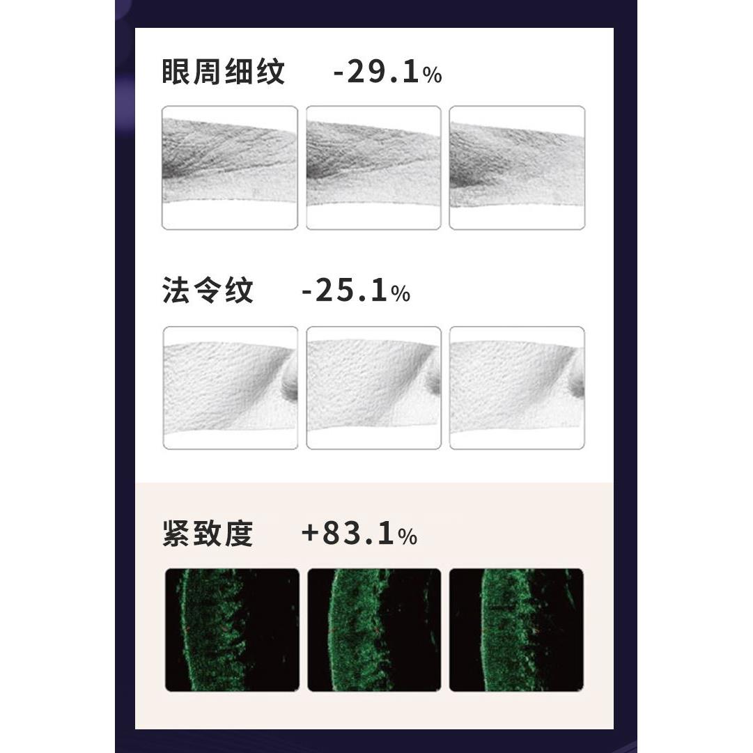 棠朵家用手持7D聚拉提美容抗衰仪器脸部提拉紧致淡纹超声波刀专用 - 图1