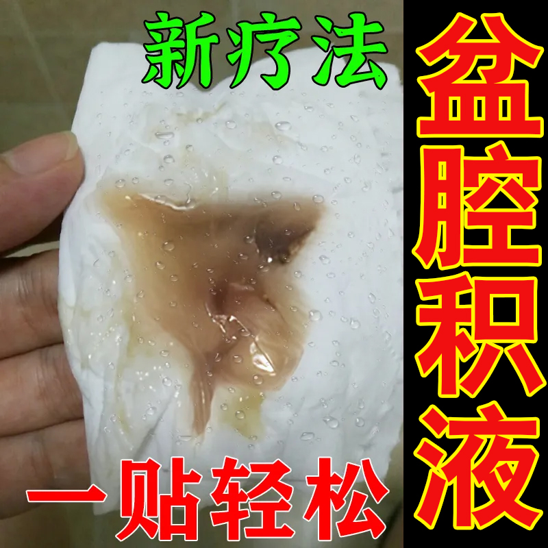 网红治疗盆腔积液消炎输卵- 管堵塞疏通的药小腹疼中药贴热敷包盆 - 图0