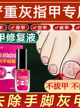 好货坏指甲增厚脚趾甲黄黑白空甲修复甲分离手指甲发黄变厚甲分层