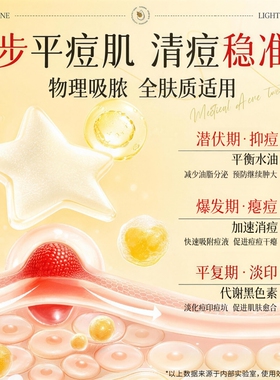 星星痘痘贴物理吸附祛痘遮痘贴纸