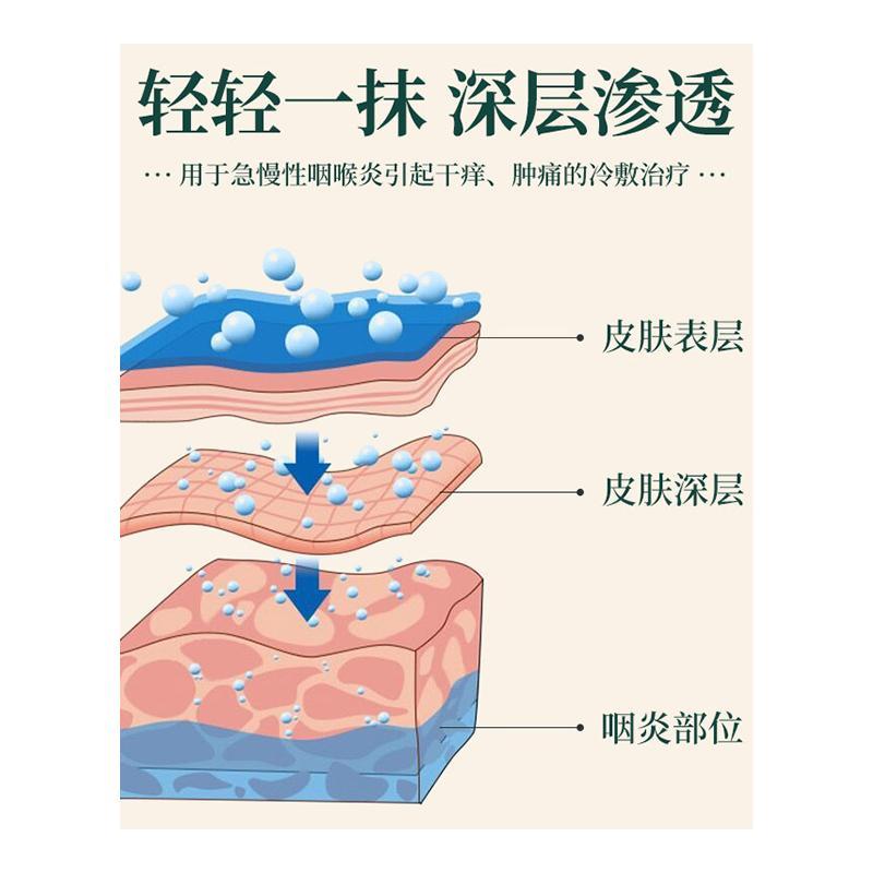 芙顺堂咽扁舒型冷敷凝胶冷敷治疗咽炎慢性咽喉炎李时珍 - 图3