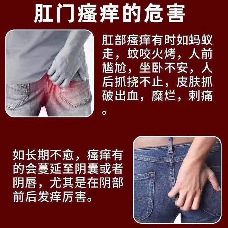 马应龙痔疮膏官方旗舰店正品肛门瘙痒屁眼痒男性肛周潮湿止痒药膏