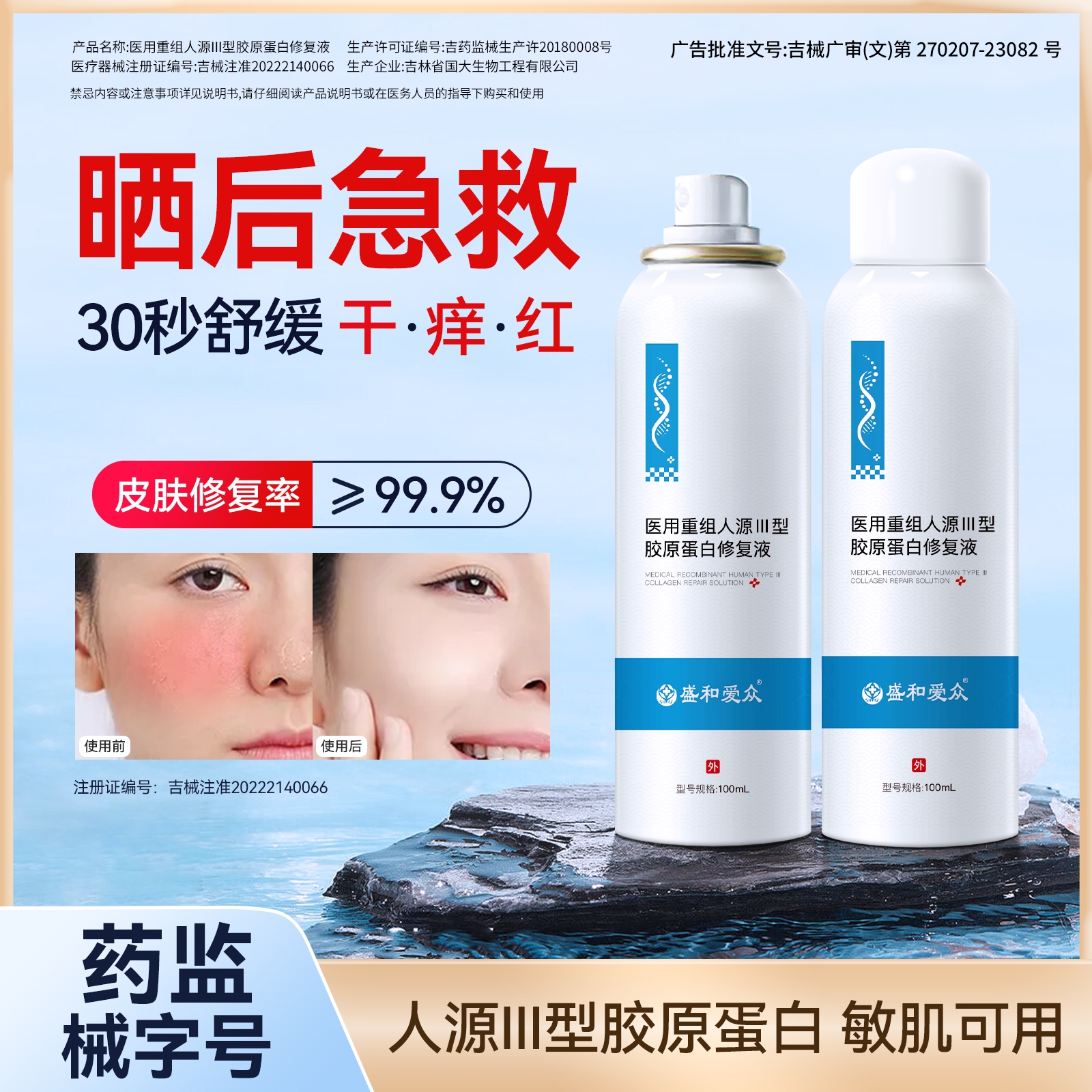 盛和爱众晒后修复喷雾非防晒胶原蛋白医用敷料儿童敏感肌补水保湿