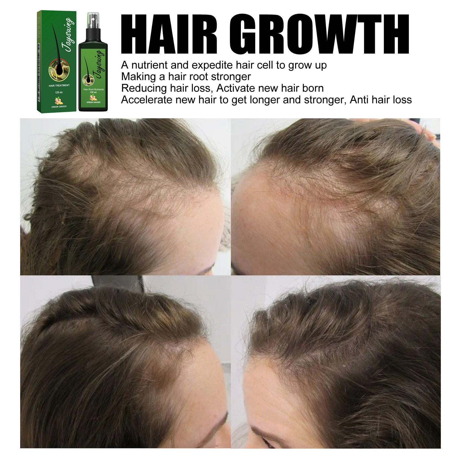 Ginger Hair Treatment Lotion Gentle Nourishing Massage Scalp - 图2