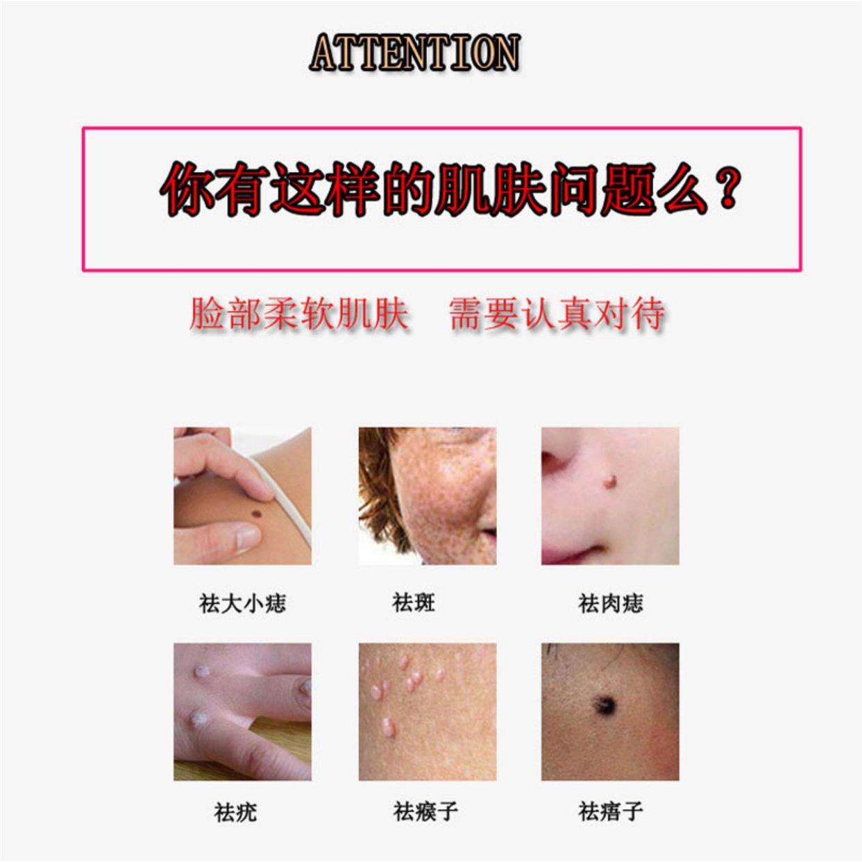 韦医生除痣灵点痣膏无痕正品点痣神器点痣水雀斑专用去痣膏脸部