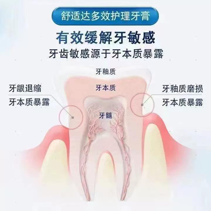 舒适达劲速抗敏牙膏官方旗舰店正品非进口专业修复护釉美白去黄ls