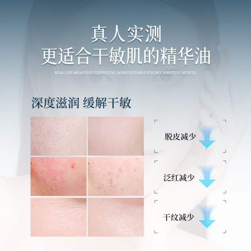 【臻愈Zefyr8号舒缓养肤油】干敏皮面部精华油保湿肌肤官方旗舰店,淘宝优惠券,粉丝福利购,淘宝优惠卷