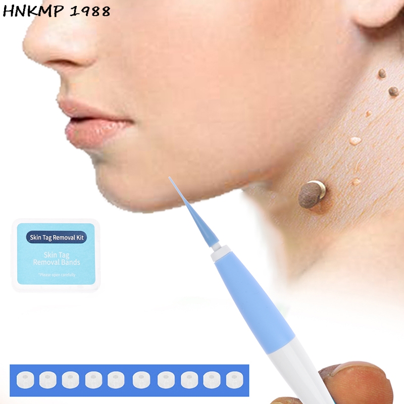 速发Skin Tag Remover To Remover Wart Spot Remover Mole Remov-图0