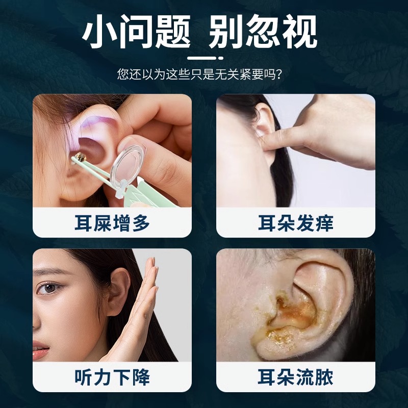 氟康唑滴耳液人用抑菌液耳朵痒中耳止消lj - 图0