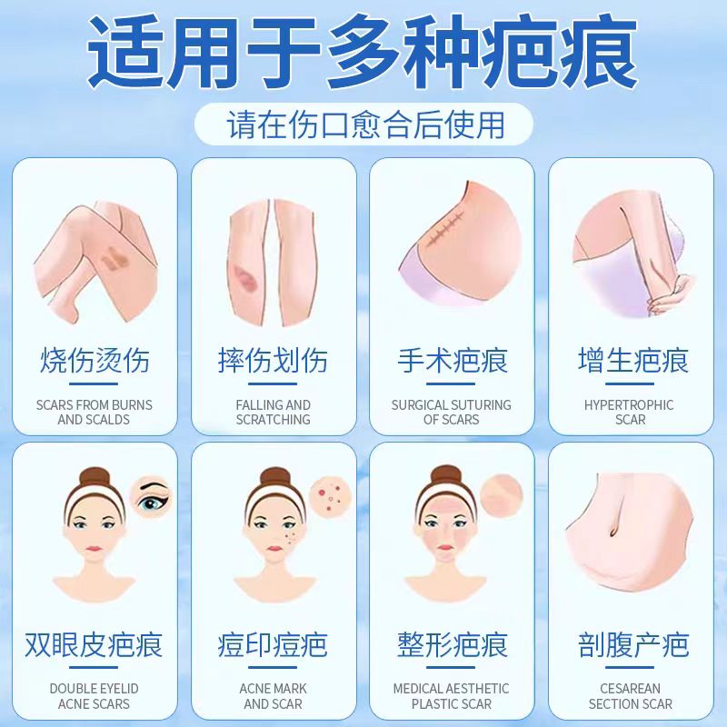 延岚医用疤痕修复凝胶祛疤膏脸部痘印复平凹凸增生疤儿童手术疤痕