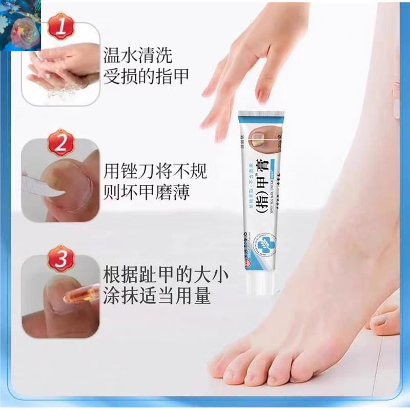 香港大药房灰趾指甲膏灰甲净新亮指甲增厚软甲膏足部护理灰甲膏