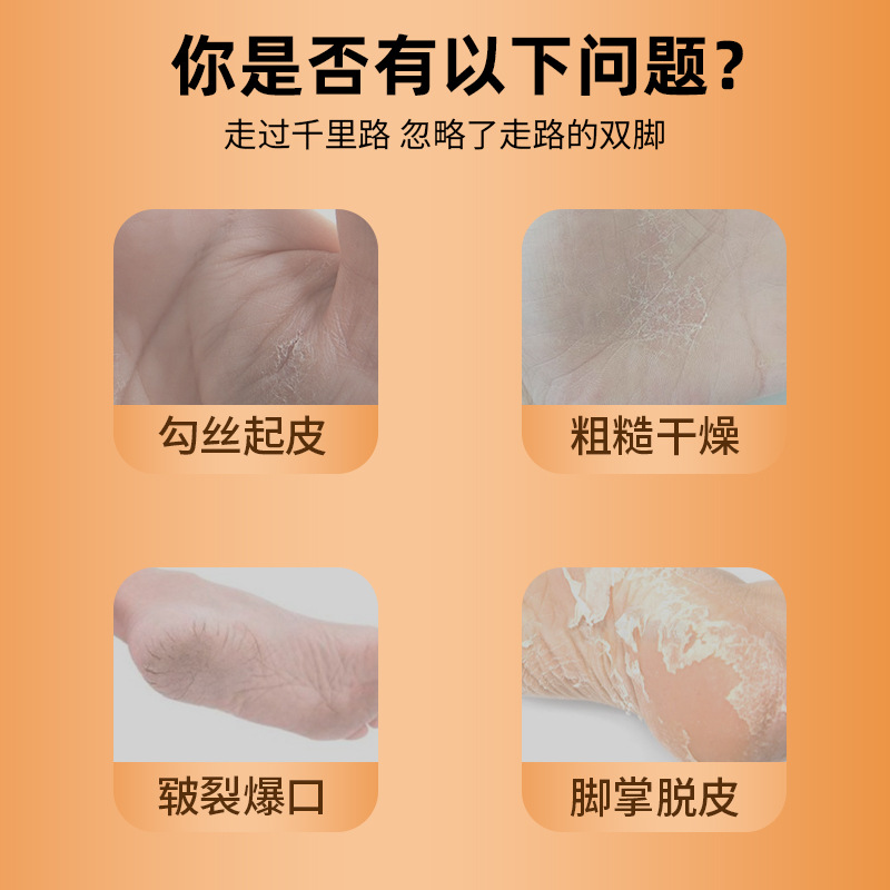 苗三叔手足脱皮软膏护理滋润脱皮脚后跟干裂皮肤