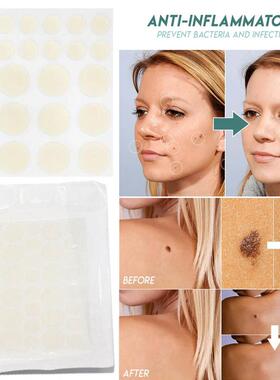 Skin Tag Remover Patch Pimple Wart Treatment Cream Quick Ab