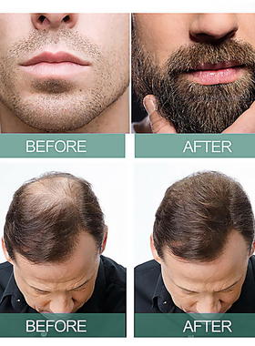 好货7 Days Ginger Hair Growth Products Fast Growing Hair Ess