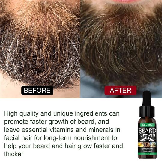 胡须油 滋养保湿胡须护理胡子油 Beard oil Beard growth fluid