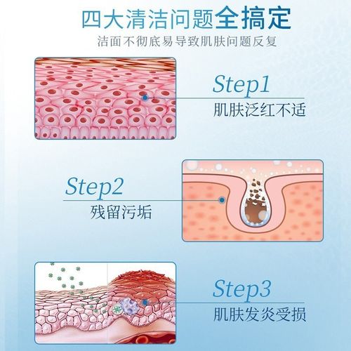 修正氨基酸洗面奶祛痘控油洁面乳深层清洁收缩肌肤学生官网正品-图0