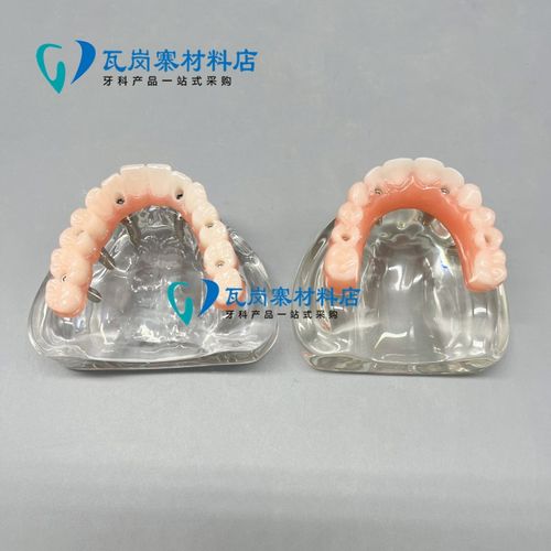 牙科口腔b模型马龙连桥义齿修复种植牙齿仿真演示模拟教学医患沟 - 图2