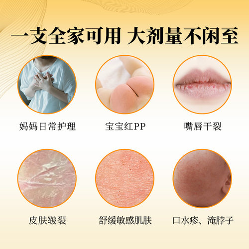 [部分效期至26年6月]tntnmoms乳头干裂膏无痛舒缓滋润修护霜3支装 - 图2