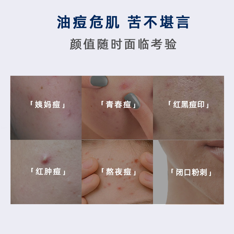 千雀颜20%壬二酸祛痘霜祛痘淡印控油去闭口粉刺黑头男女15g