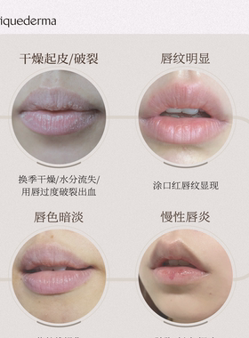 优研达多效倍护男士润唇膏