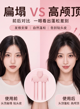 ovl电热颅顶夹蓬松发夹神器