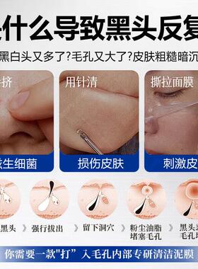 白泥清洁泥膜黑头粉刺闭口毛孔垃圾超强吸附