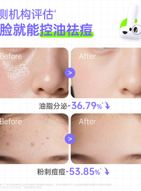 黑色木星青少年洗面奶控油祛痘青春期男女护肤套装氨基酸洁面乳