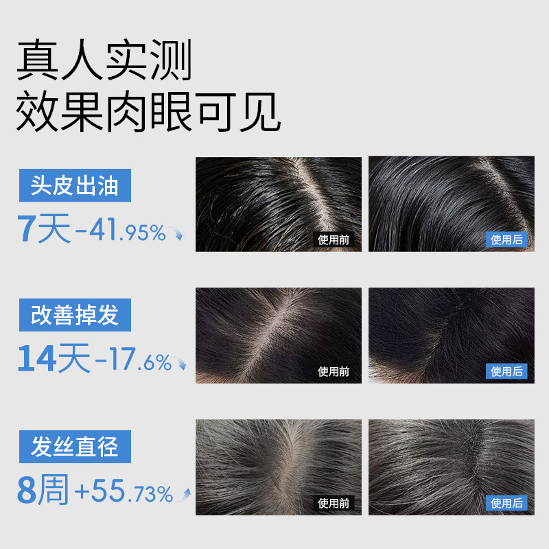 KOSHINE826育发液头发增长液男女士清爽控油喷雾护理头皮精华液