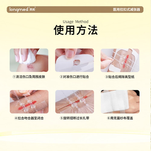 longmed灵扣朗特医用减张器剖腹产手术减张贴拉扣式免缝疤痕闭合 - 图1