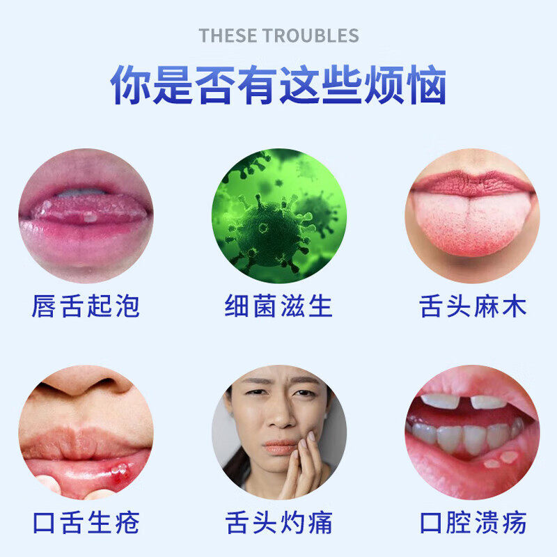 口腔溃疡专用药贴烂嘴巴烂舌头口舌生疮起泡灼痛反复口疮溃疡肿痛