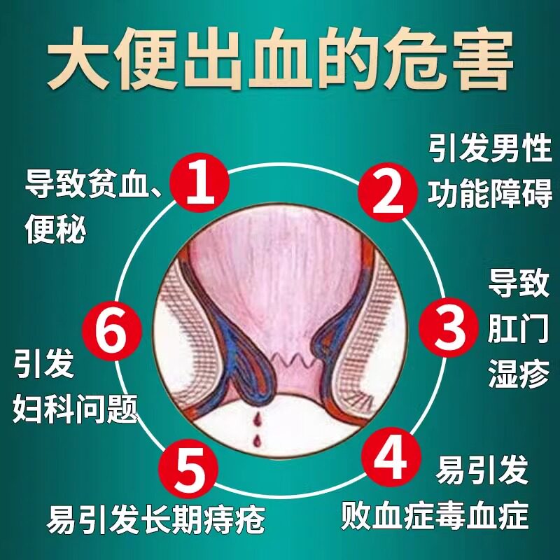 槐角丸痔疮消肉球口服药官方旗舰店痔疮止血特专效药大便出血专用