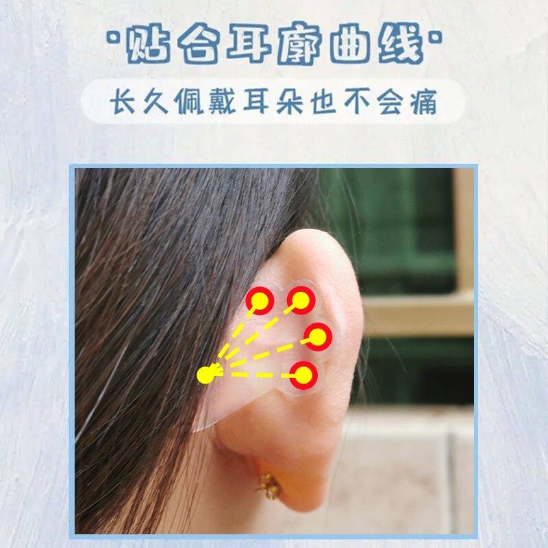 猫爪精灵耳贴耳朵隐形定型强支撑力神器器贴面立耳矫正显小脸