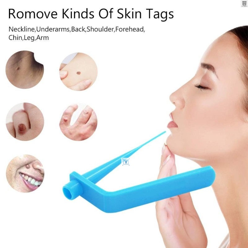 新品Skin tag remover wart Remove Acne Pimple Blemish Treatme-图0