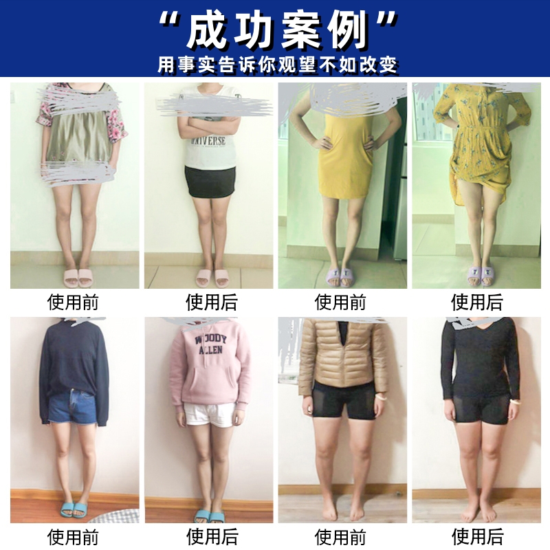 成人直腿神器o型X型小腿外翻矫正鞋垫扁平足弓支撑垫鞋防止鞋底磨 - 图3