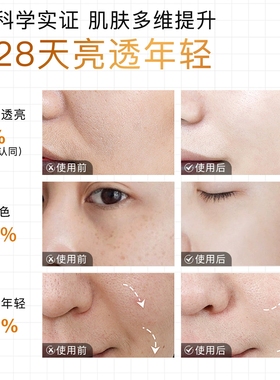 [U先试用]NOVEXPERT诺士博30VC精华试用装1ml*4片+70元正装回购券