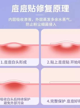星星痘痘贴型遮盖痘印隐形可上妆
