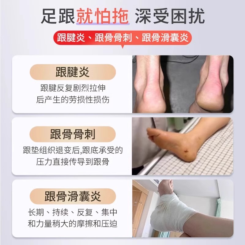 史医生督灸足跟止痛型改善足跟痛去脚后跟疼痛脚底骨刺膏药贴