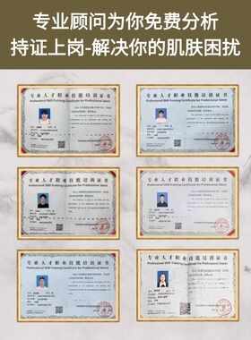 【先咨询，再下单】正宗祛斑霜祛黄褐斑雀斑老年斑晒斑淡色斑祛斑