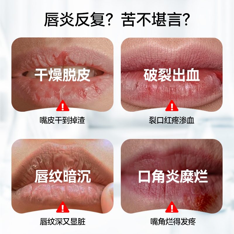 LAPOR医用聚乙二醇保湿敷料创面保护唇部润滑保湿修护养唇A