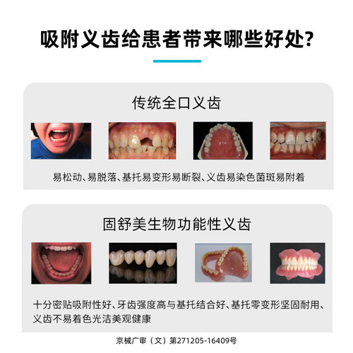 吸附义齿功能性老人活动半口假牙定制全口活动牙当天戴牙全国定制 - 图2