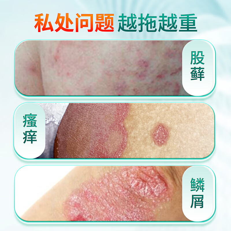 股藓大腿内侧真菌感染皮肤皮炎湿疹阴囊潮湿瘙痒杀菌止痒药膏